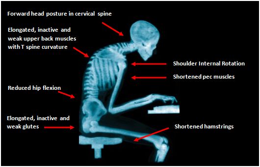 Poor posture: more damaging than you'd think!